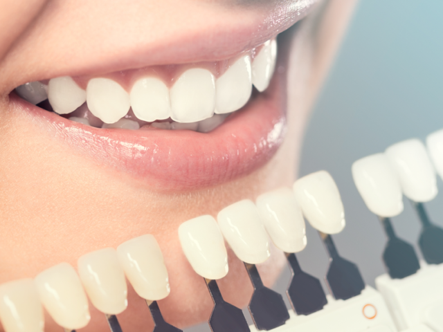 Orthodontic Retainers: Maintaining Straight Teeth